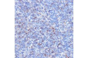 Immunohistochemistry of paraffin-embedded mouse spleen using NOTCH3 antibody (ABIN6134401, ABIN6144738, ABIN6144739 and ABIN6217553) at dilution of 1:100 (40x lens). (NOTCH3 Antikörper  (C-Term))