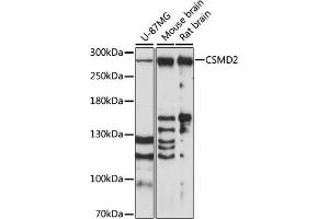 Western blot analysis of extracts of various cell lines, using CSMD2 antibody (ABIN7266537) at 1:1000 dilution. (CSMD2 Antikörper  (AA 2050-2150))