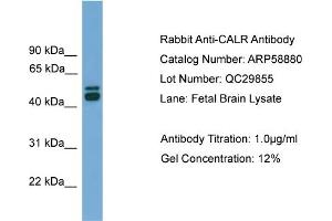 WB Suggested Anti-CALR  Antibody Titration: 0. (Calreticulin Antikörper  (Middle Region))