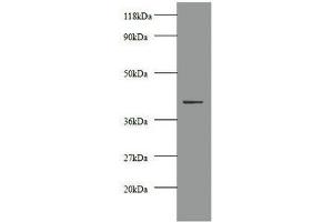 Western blot All lanes: Creatine kinase M-type antibody at 2 μg/mL + 293T whole cell lysate Secondary Goat polyclonal to rabbit IgG at 1/10000 dilution Predicted band size: 44 kDa Observed band size: 44 kDa (CKM Antikörper  (AA 1-379))