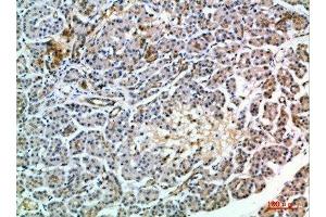 Immunohistochemical analysis of paraffin-embedded human-pancreas, antibody was diluted at 1:200 (MIA2 Antikörper  (AA 361-410))