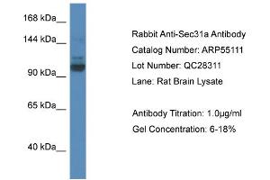 Western Blotting (WB) image for anti-SEC31 Homolog A (SEC31A) (N-Term) antibody (ABIN2786062) (SEC31A Antikörper  (N-Term))