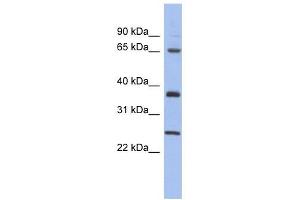 HORMAD2 antibody used at 1 ug/ml to detect target protein. (HORMAD2 Antikörper  (Middle Region))