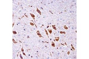 PAK3 antibody immunohistochemistry analysis in formalin fixed and paraffin embedded mouse brain tissue. (PAK3 Antikörper  (AA 124-152))