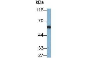 Detection of OCTN1 in Rat Thymus lysate using Polyclonal Antibody to Organic Cation/Ergothioneine Transporter (OCTN1) (SLC22A4 Antikörper  (AA 42-141))
