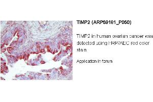 Image no. 2 for anti-Metalloproteinase Inhibitor 2 (TIMP2) (Middle Region) antibody (ABIN2787968) (TIMP2 Antikörper  (Middle Region))