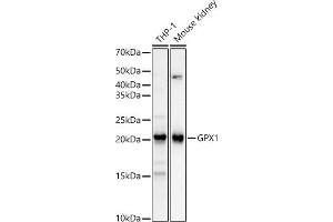 Western blot analysis of extracts of various cell lines, using GPX1 Rabbit mAb (ABIN7267434) at 1:12000 dilution. (Glutathione Peroxidase 1 Antikörper)