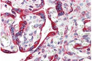Human Placenta: Formalin-Fixed, Paraffin-Embedded (FFPE) (Calnexin Antikörper  (AA 504-593))