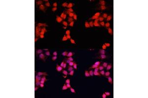 Immunofluorescence analysis of HeLa cells using ENO3 antibody (ABIN7266960) at dilution of 1:100. (ENO3 Antikörper  (AA 1-190))