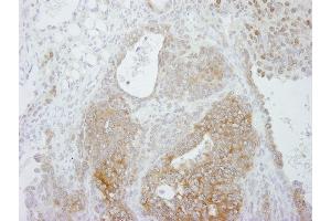 Immunohistochemistry (IHC) image for anti-Protein Arginine Methyltransferase 5 (PRMT5) (C-Term) antibody (ABIN7448743) (PRMT5 Antikörper  (C-Term))