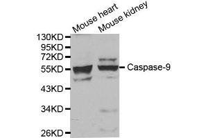 Western blot analysis of extracts of mouse heart and kidney tissue, using CASP9 antibody.