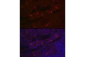 Immunofluorescence analysis of rat spleen cells using CD25 Rabbit pAb (ABIN3017118, ABIN3017119, ABIN3017120 and ABIN6219963) at dilution of 1:100 (40x lens). (CD25 Antikörper)