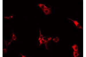 ABIN6274137 staining HepG2 by IF/ICC. (TNFRSF6B Antikörper)