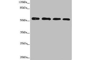 Western blot All lanes: CALCOCO2 antibody at 3. (CALCOCO2 Antikörper  (AA 137-446))