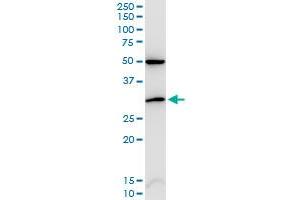CDKN1B monoclonal antibody (M02), clone 2F4. (CDKN1B Antikörper  (AA 100-198))