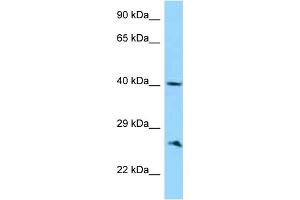 WB Suggested Anti-ABI1 Antibody Titration: 1. (ABI1 Antikörper  (C-Term))