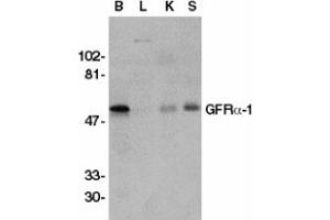 Image no. 2 for anti-GDNF Family Receptor alpha 1 (GFRA1) (AA 369-382) antibody (ABIN201472) (GFRA1 Antikörper  (AA 369-382))