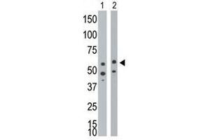 Image no. 1 for anti-Bone Morphogenetic Protein Receptor 1A (BMPR1A) (Middle Region) antibody (ABIN357375) (BMPR1A Antikörper  (Middle Region))