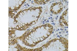 Immunohistochemistry of paraffin-embedded Human stomach using SIGMAR1 Polyclonal Antibody (SIGMAR1 Antikörper)