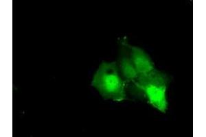 Anti-KHK mouse monoclonal antibody (ABIN2453198) immunofluorescent staining of COS7 cells transiently transfected by pCMV6-ENTRY KHK (RC202424). (Ketohexokinase Antikörper)