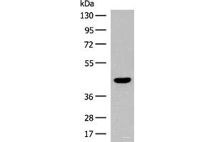 Western blot analysis of Human fetal brain tissue lysate using S1PR5 Polyclonal Antibody at dilution of 1:200 (S1PR5 Antikörper)