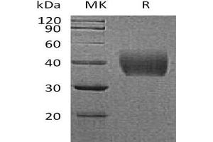 Western Blotting (WB) image for Coagulation Factor III (thromboplastin, Tissue Factor) (F3) protein (His tag) (ABIN7320770) (Tissue factor Protein (His tag))