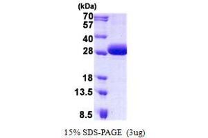 DiGeorge Syndrome Critical Region Gene 6 (DGCR6) protein (His tag)