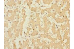 Immunohistochemistry of paraffin-embedded human liver tissue using ABIN7167108 at dilution of 1:100 (RAPGEF4 Antikörper  (AA 1-210))