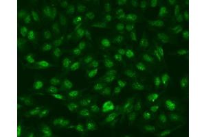 IF analysis of RNF168 using anti-RNF168 antibody (ABIN7601889).