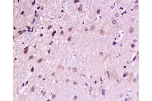 Formalin-fixed and paraffin embedded: rat brain tissue labeled with Anti-TrkB Polyclonal Antibody, Unconjugated  at 1:200, followed by conjugation to the secondary antibody and DAB staining (TRKB Antikörper  (AA 32-120))