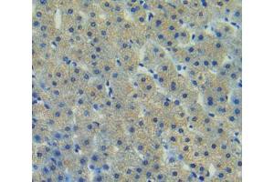 Used in DAB staining on fromalin fixed paraffin- embedded liver tissue (FAK Antikörper  (AA 798-1041))