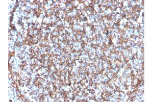 Immunohistochemistry (IHC) image for anti-Integrin alpha M (ITGAM) (AA 941-1074) antibody (ABIN6939810)