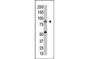 The anti-IKKbeta Mab (ABIN1882049 and ABIN2843911) is used in Western blot to detect IKKbeta in SK-BR3 cell lysate. (IKBKB Antikörper)