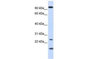Image no. 1 for anti-Guanylate Cyclase Activator 1A (Retina) (GUCA1A) (AA 36-85) antibody (ABIN6743766) (GCAP1 Antikörper  (AA 36-85))