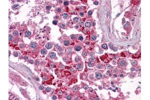 Human Testis: Formalin-Fixed, Paraffin-Embedded (FFPE) (BIRC3 Antikörper)