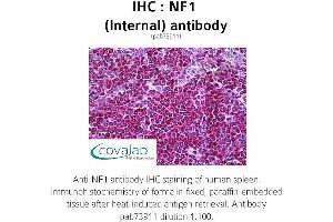 Image no. 2 for anti-Neurofibromin 1 (NF1) (Internal Region) antibody (ABIN1737327) (Neurofibromin 1 Antikörper  (Internal Region))