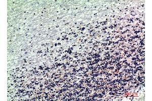 Immunohistochemical analysis of paraffin-embedded human-brain, antibody was diluted at 1:200