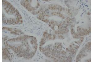 Immunohistochemistry (IHC) image for anti-Tumor Protein P53 (TP53) antibody (ABIN1108553) (p53 Antikörper)