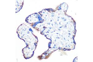 Immunohistochemistry of paraffin-embedded human placenta using Epac1/R Rabbit mAb (ABIN7269850) at dilution of 1:100 (40x lens). (RAPGEF3 Antikörper)