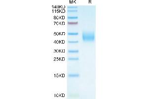 Cynomolgus B7-H6 on Tris-Bis PAGE under reduced condition. (B7-H6 Protein (AA 25-259) (His tag))