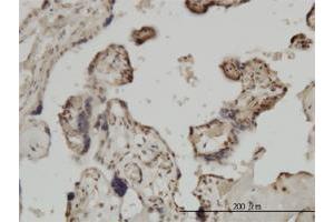 Immunoperoxidase of monoclonal antibody to ZIC4 on formalin-fixed paraffin-embedded human placenta. (ZIC4 Antikörper  (AA 249-319))