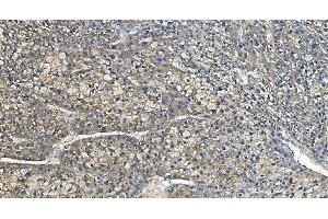 IHC analysis of Carbonic Anhydrase I/CA1 using anti-Carbonic Anhydrase I/CA1 antibody (ABIN7602620).