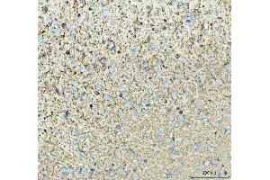 IHC analysis of TNR using anti-TNR antibody (ABIN4886752).