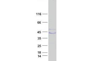 Western Blotting (WB) image for Plasminogen Activator, Urokinase Receptor (PLAUR) (Transcript Variant 1) protein (Myc-DYKDDDDK Tag) (ABIN2713801)