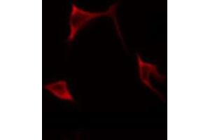 ABIN6268699 staining HeLa by IF/ICC. (BMP3 Antikörper  (Internal Region))