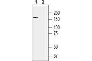 Western blot analysis of human U-87 MG glioblastoma cell line lysate: - 1. (SLITRK2 Antikörper  (Extracellular, N-Term))