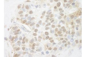 anti-Pygopus Homolog 2 (PYGO2) (AA 1-50) antibody