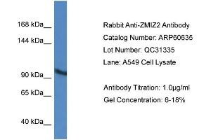 Western Blotting (WB) image for anti-Zinc Finger, MIZ-Type Containing 2 (ZMIZ2) (Middle Region) antibody (ABIN2788517) (ZMIZ2 Antikörper  (Middle Region))