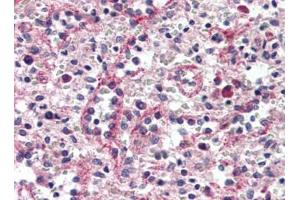 Human Spleen, Red Pulp (formalin-fixed, paraffin-embedded) stained with CTNND1at 1/15 followed by biotinylated goat anti-rabbit IgG secondary antibody, alkaline phosphatase-streptavidin and chromogen. (CTNND1 Antikörper  (C-Term))
