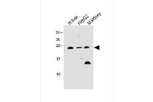 All lanes : Anti-Erythropoietin Antibody at 1:500 dilution Lane 1: Human liver lysate Lane 2: HepG2 whole cell lysate Lane 3: Mouse kidney lysate Lysates/proteins at 20 μg per lane. (EPO Antikörper)